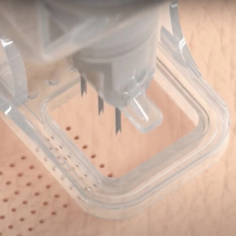 Ellacor Micro-Coring Skin Tightening, Marquis Plastic Surgery, Miami, FL.