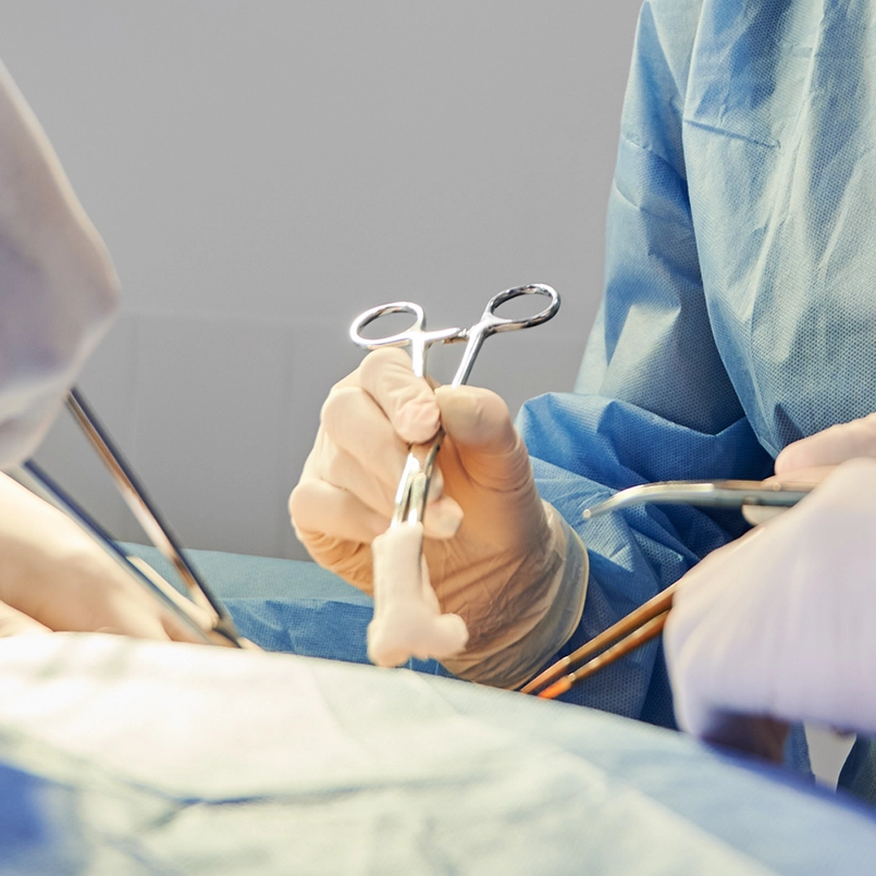 Image of surgery for frontal orbital advancement. Photo for Marquis Plastic Surgery, Coral Gables, Miami, West Palm Beach, Florida.