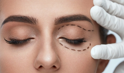 Image for eyelid surgery. Photo from Marquis Plastic Surgery, Coral Gables, Miami, West Palm Beach, Florida.