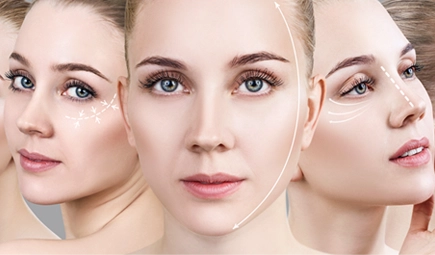 Stock, Endoscopic Deep Plane Facelift, for Marquis Plastic Surgery, Miami, FL.