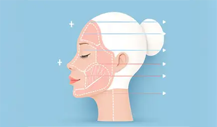 Facial fat grafting at Marquis Plastic Surgery in Miami to restore volume, Dr. Arthur E. Desrosiers III.